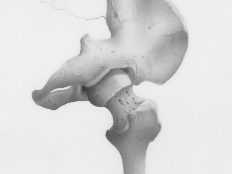 股関節の「詰まり感」は要注意？変形性股関節症のリスクと今からできる対策